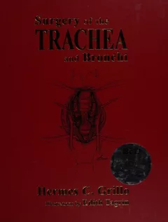 Surgery of the trachea and bronchi