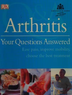 Arthritis