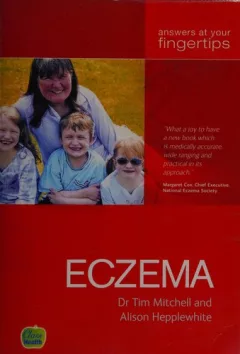 Eczema