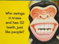 Whose teeth are these?