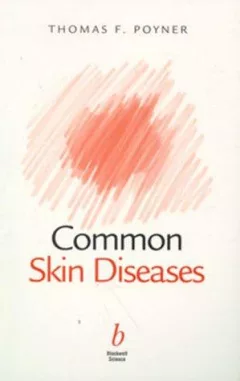 Common Skin Diseases (Managing in Primary Care)