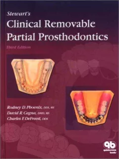 Stewart's Clinical Removable Partial Prosthodontics (Phoenix, Stewart's Clinical Removable Partial Prosthodontics)