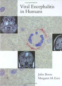Viral Encephalitis in Humans