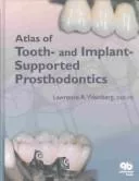 Atlas of Tooth- And Implant-Supported Prosthodontics