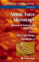Atomic force microscopy