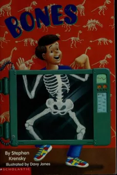 Bones