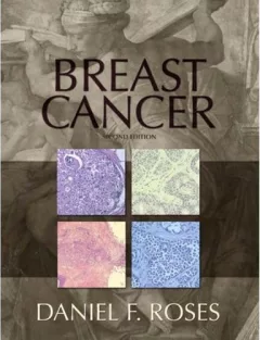 Breast cancer