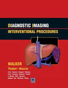 Interventional Procedures